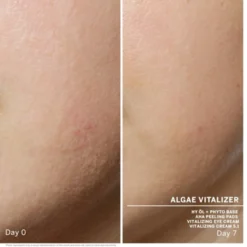 Babor Algae Vitalizer Ampoule Concentrates -Exporteren Zalfje Pro Winkel 1072268 3