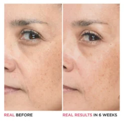 IT Cosmetics Bye Bye Lines Hyaluronic Acid Serum 9 IT Cosmetics Bye Bye Lines Hyaluronic Acid Serum -Exporteren Zalfje Pro Winkel 1072752 5