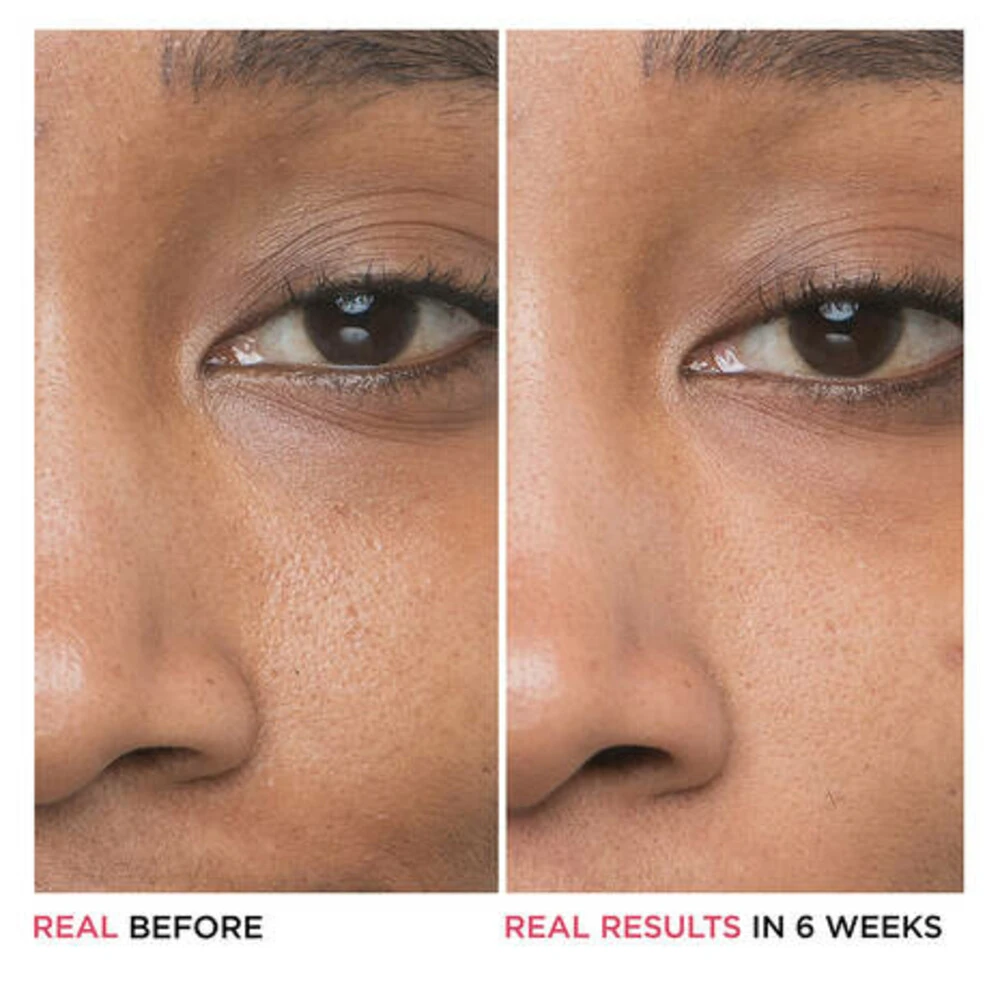 IT Cosmetics Bye Bye Pores Glycolic Acid Serum 5 IT Cosmetics Bye Bye Pores Glycolic Acid Serum - Afbeelding 5